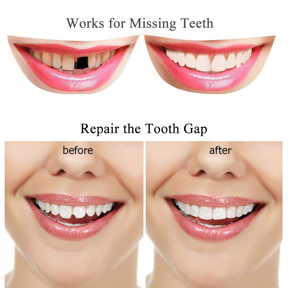 Color matching with coffee or tea for natural tooth repair