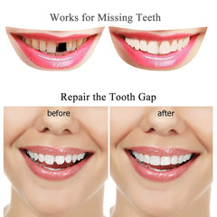 Color matching with coffee or tea for natural tooth repair