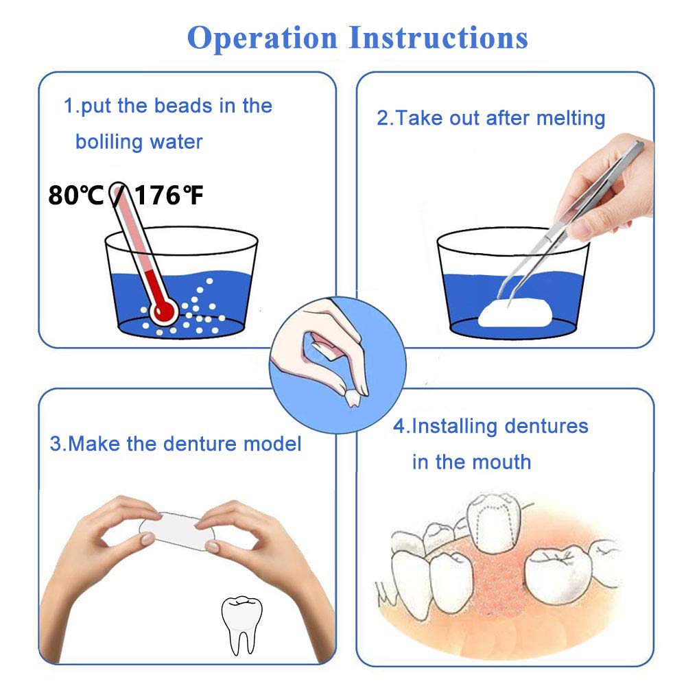 Temporary tooth repair being formed and set