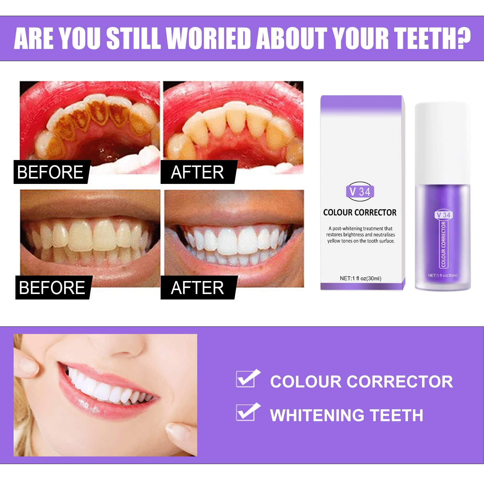 Toothpaste whitening stain removal close-up