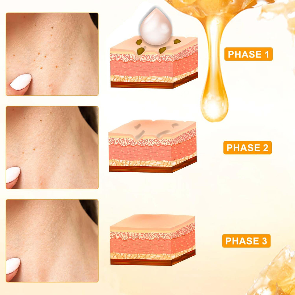 Traboto Bee Venom Cream applied on the feet to moisturize dry skin without residue