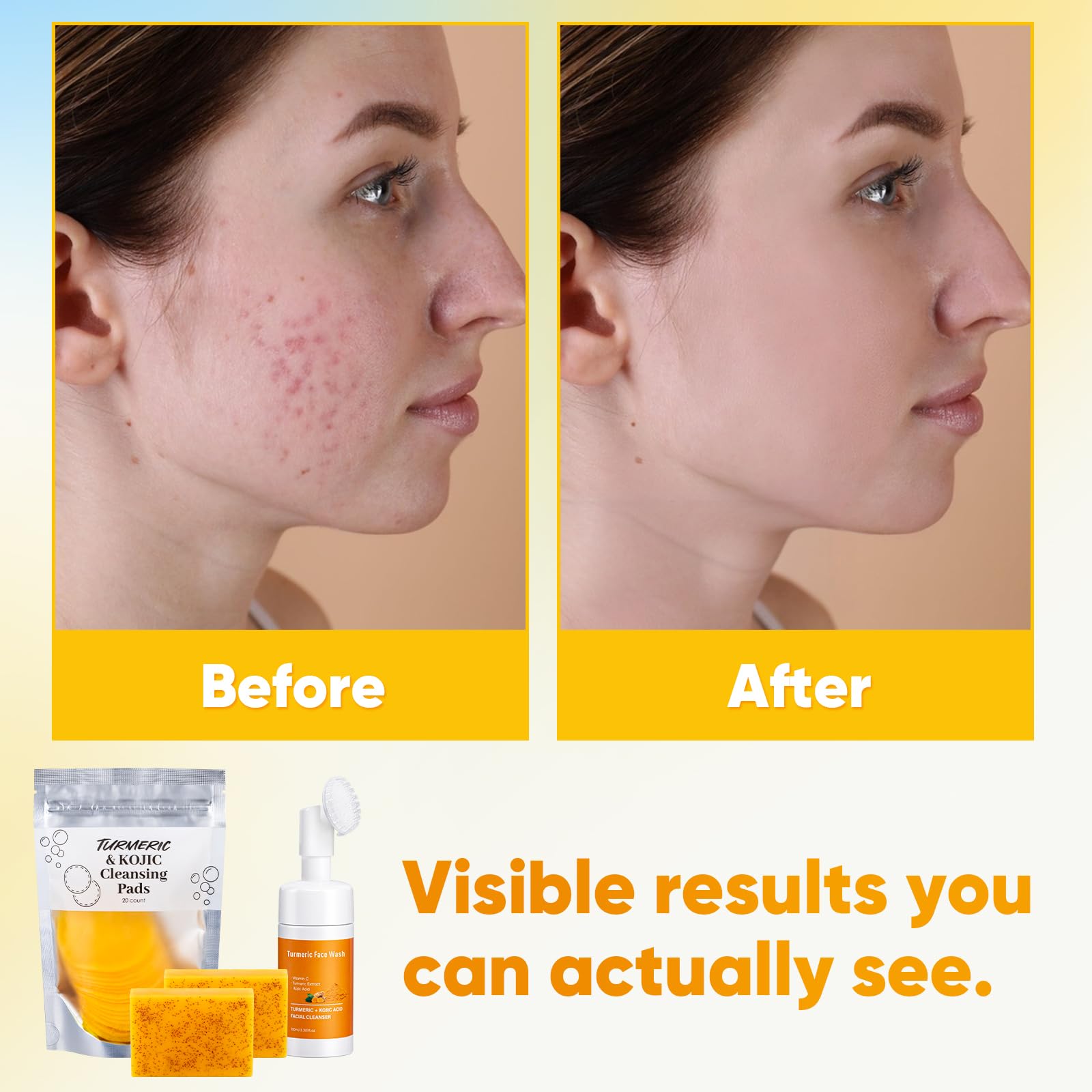 Treeroot turmeric face wash bottle delivering gentle cleansing with natural oils.