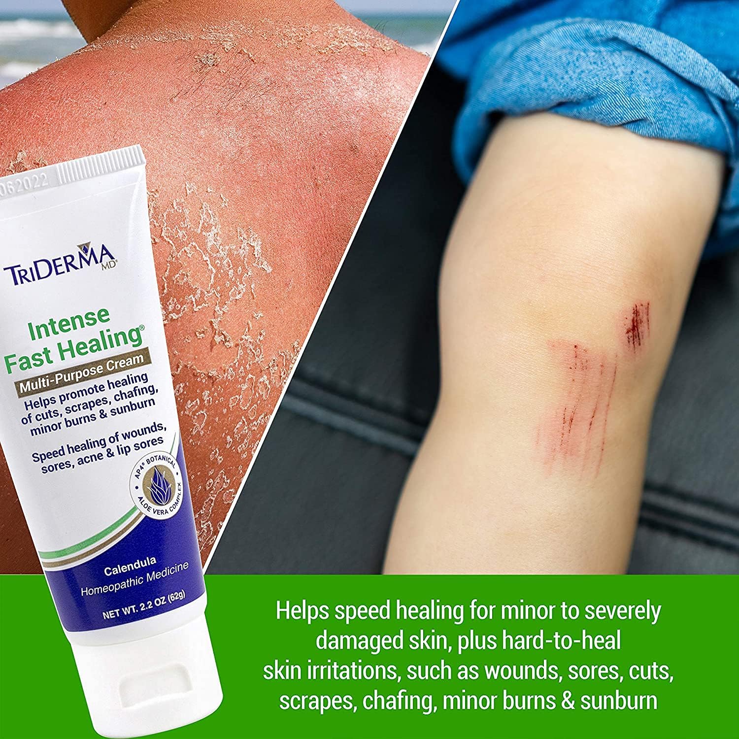 TriDerma MD Intense Fast Healing Cream packaging box on display