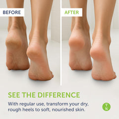Truremedy Naturals Remedy Balm nourishing ingredients closeup for skin nourishment
