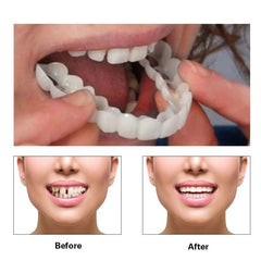 Double-pack smile supports with natural white finish