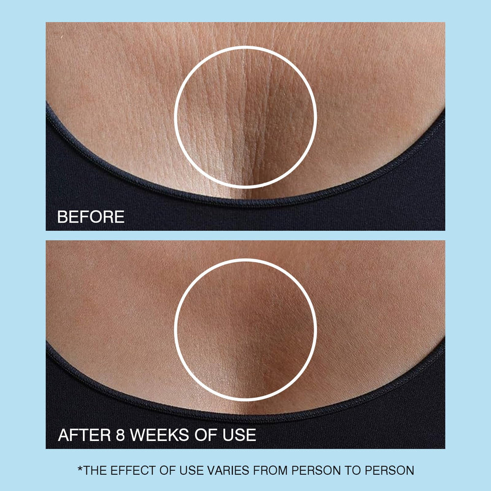 UJhay Neck Cream spread across neck and chest area showing smooth skin.