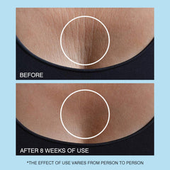 UJhay Neck Cream spread across neck and chest area showing smooth skin.