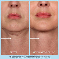 UJhay Retinol Neck Cream packaging and product display.