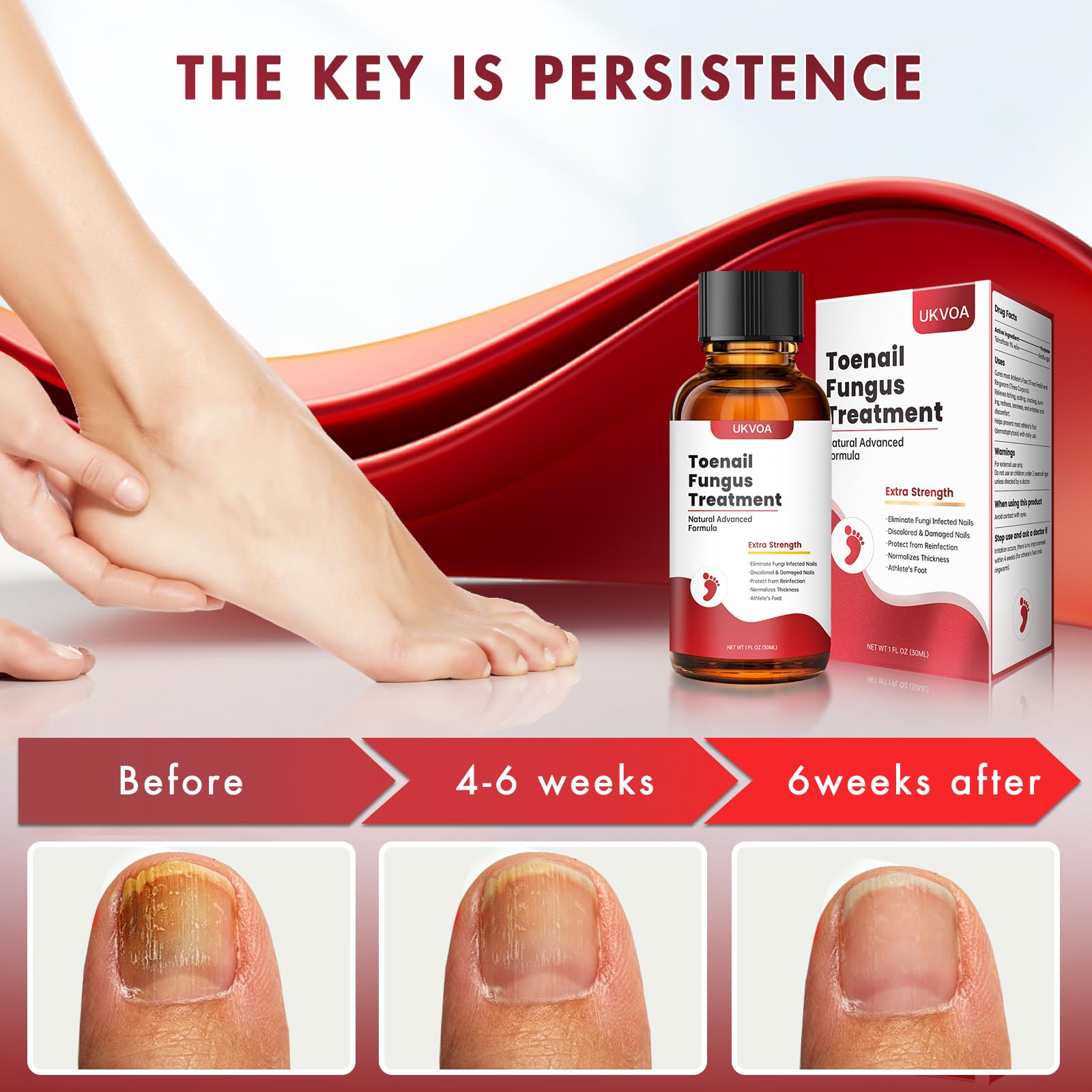 UKVOA nail repair supports smoother, clearer nail appearance over time.