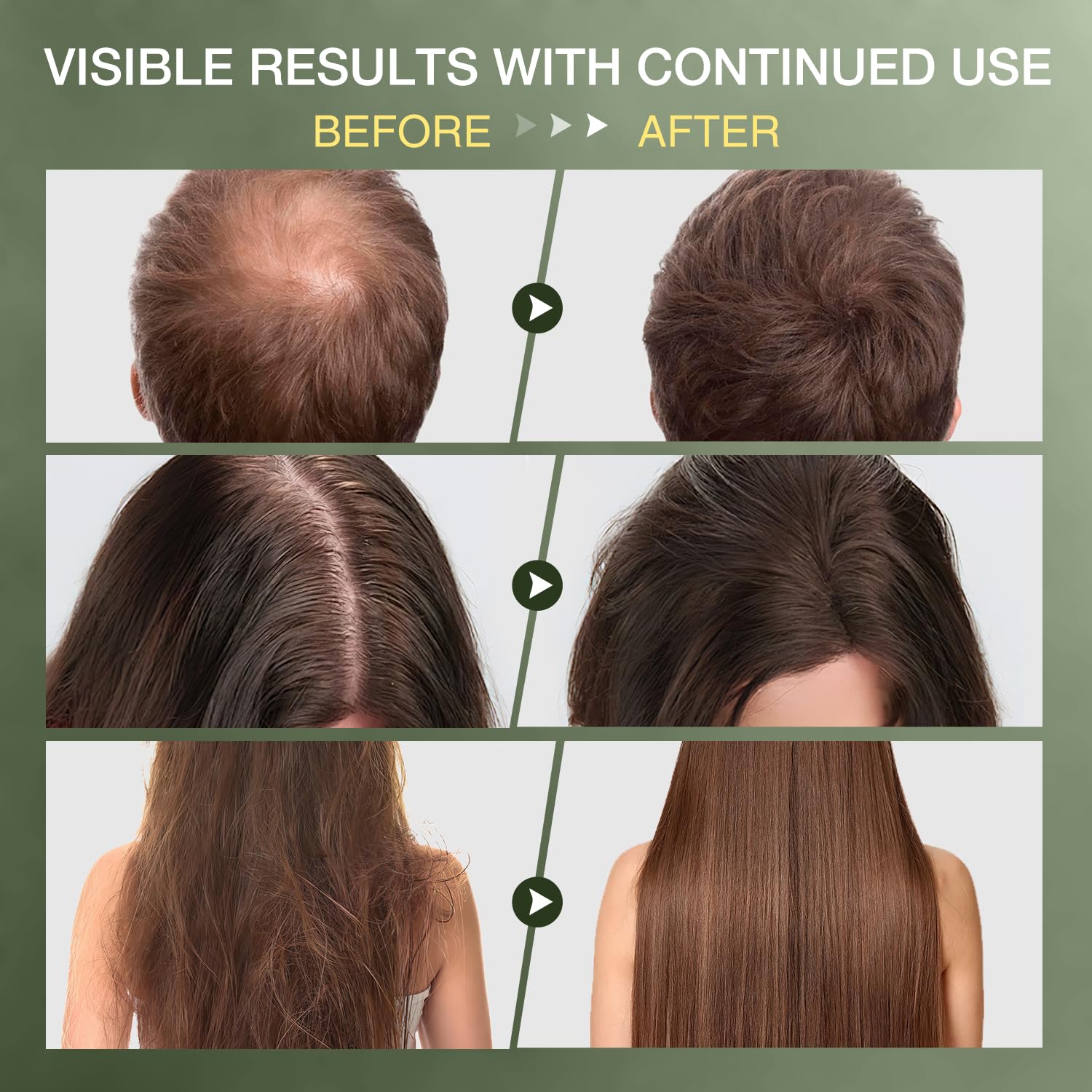 ulluxe Batana Oil application scene shows easy scalp massage for hair growth support