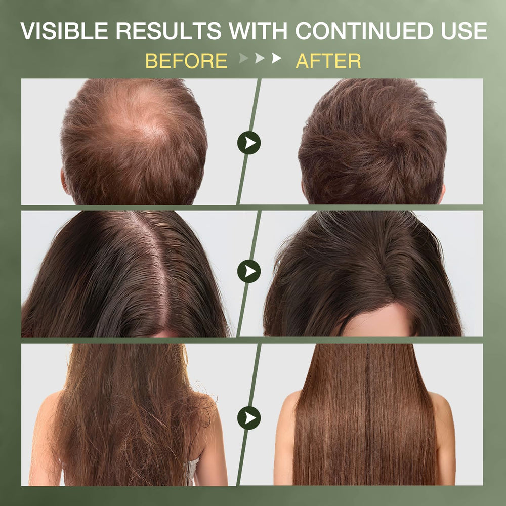 ulluxe Batana Oil application scene shows easy scalp massage for hair growth support