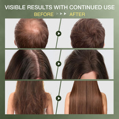ulluxe Batana Oil application scene shows easy scalp massage for hair growth support