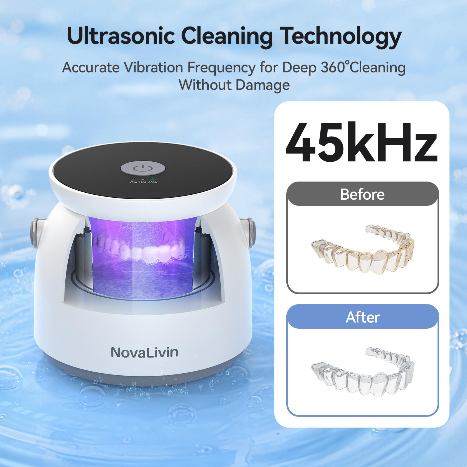 Retainers and dentures being cleaned in the ultrasonic device