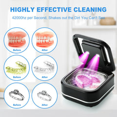Dentures and retainers soaking in cleaning solution in the basin