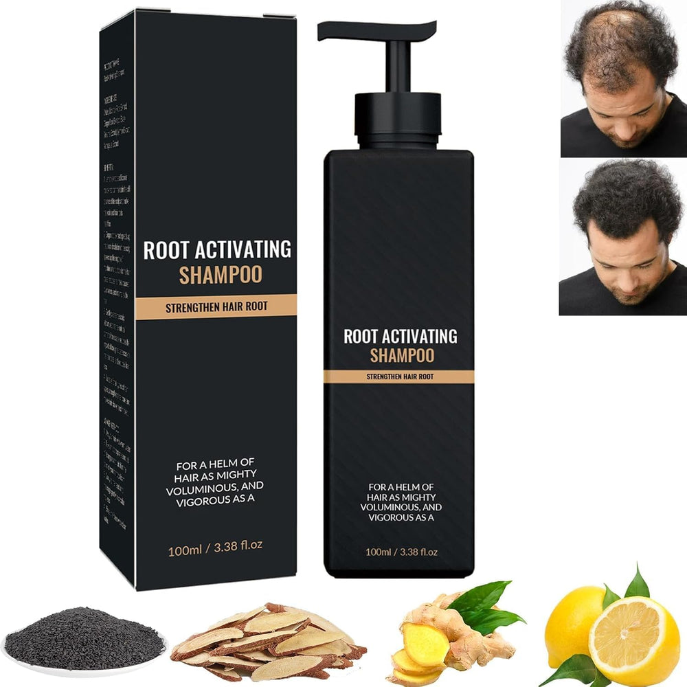 UN UNITEDTIME Root Activator shampoo bottle close-up for daily scalp nourishment.