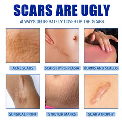 URABOS family-friendly scar cream suitable for all ages and skin types.