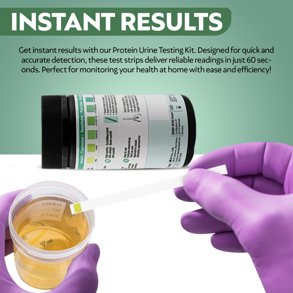 Urinalysis color chart on the strip wrapper