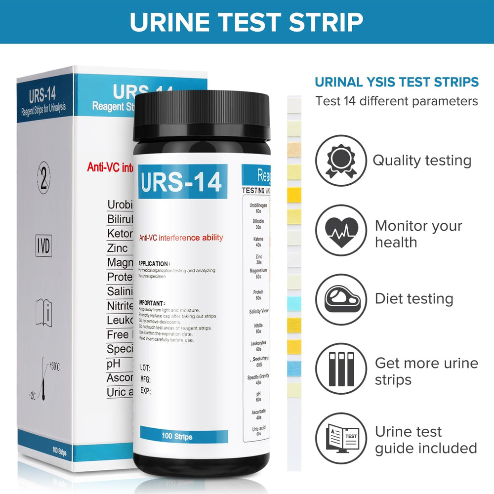 Close-up of urine test strip showing color chart