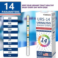 Test strip dipped in urine with color comparison chart