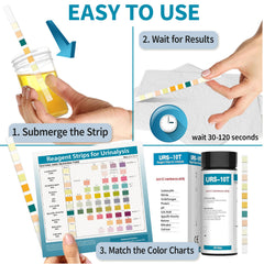 Close-up of 10 parameter indicators on URS test strip