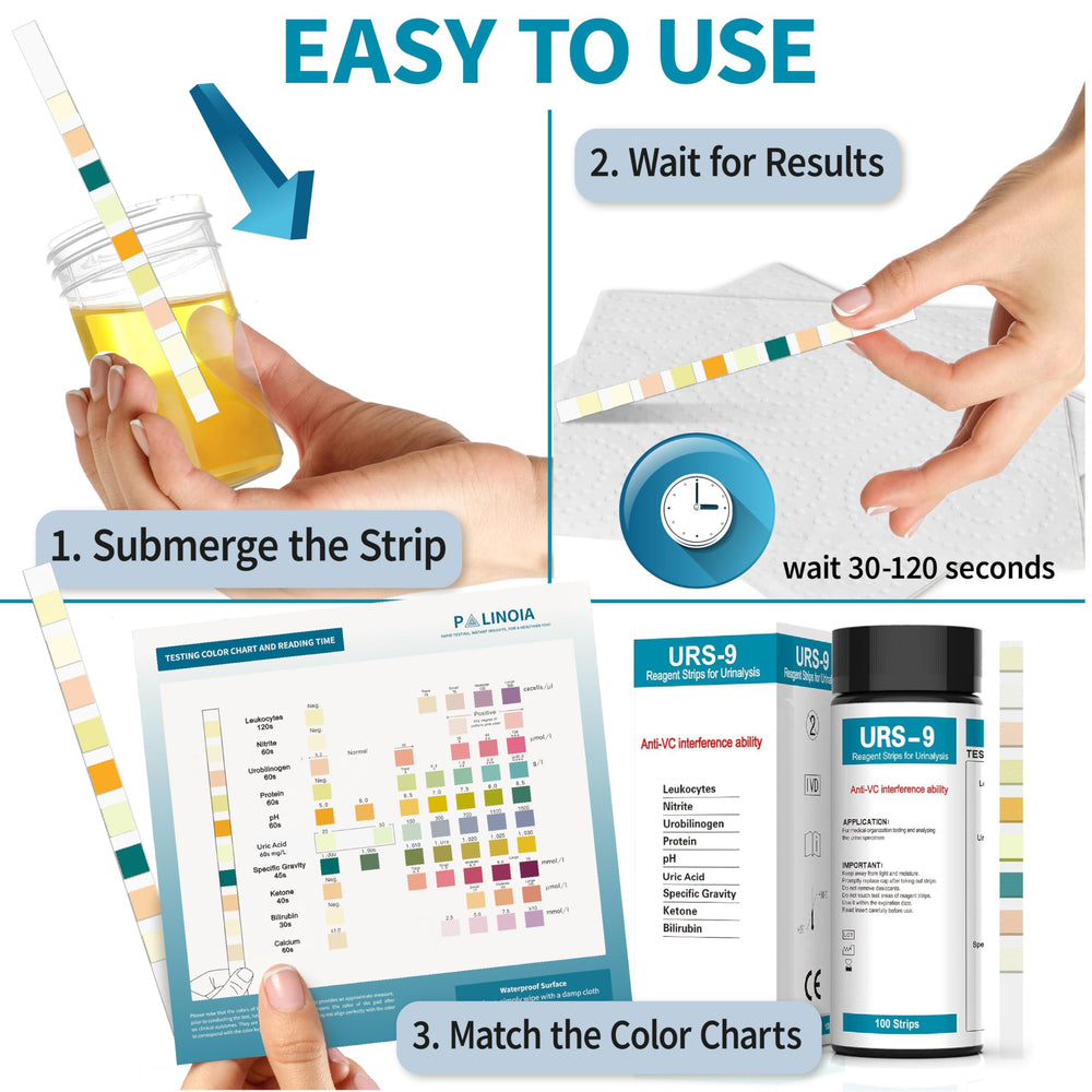 Leukocytes and nitrite test pads on the strip
