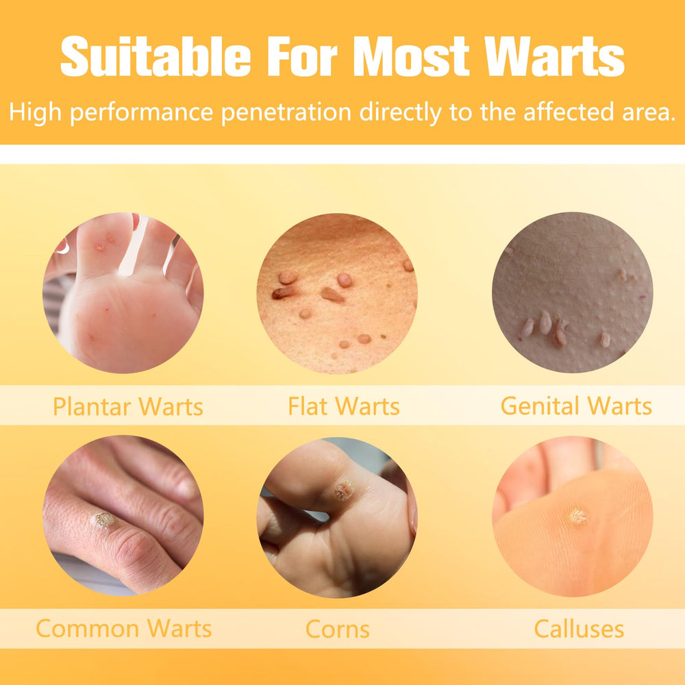 URSEORY Skin Tag Remover fine-tip applicator—precise application to isolated wart.