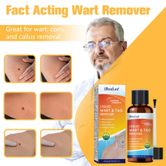 URSEORY Wart Remover liquid bottle—12% salicylic acid formula for targeted use.