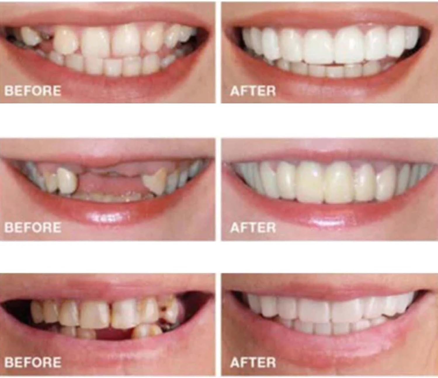 User-friendly cleaning and preparation of aligners