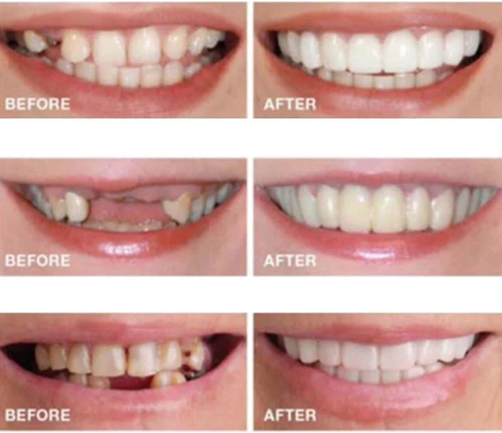 User-friendly cleaning and preparation of aligners