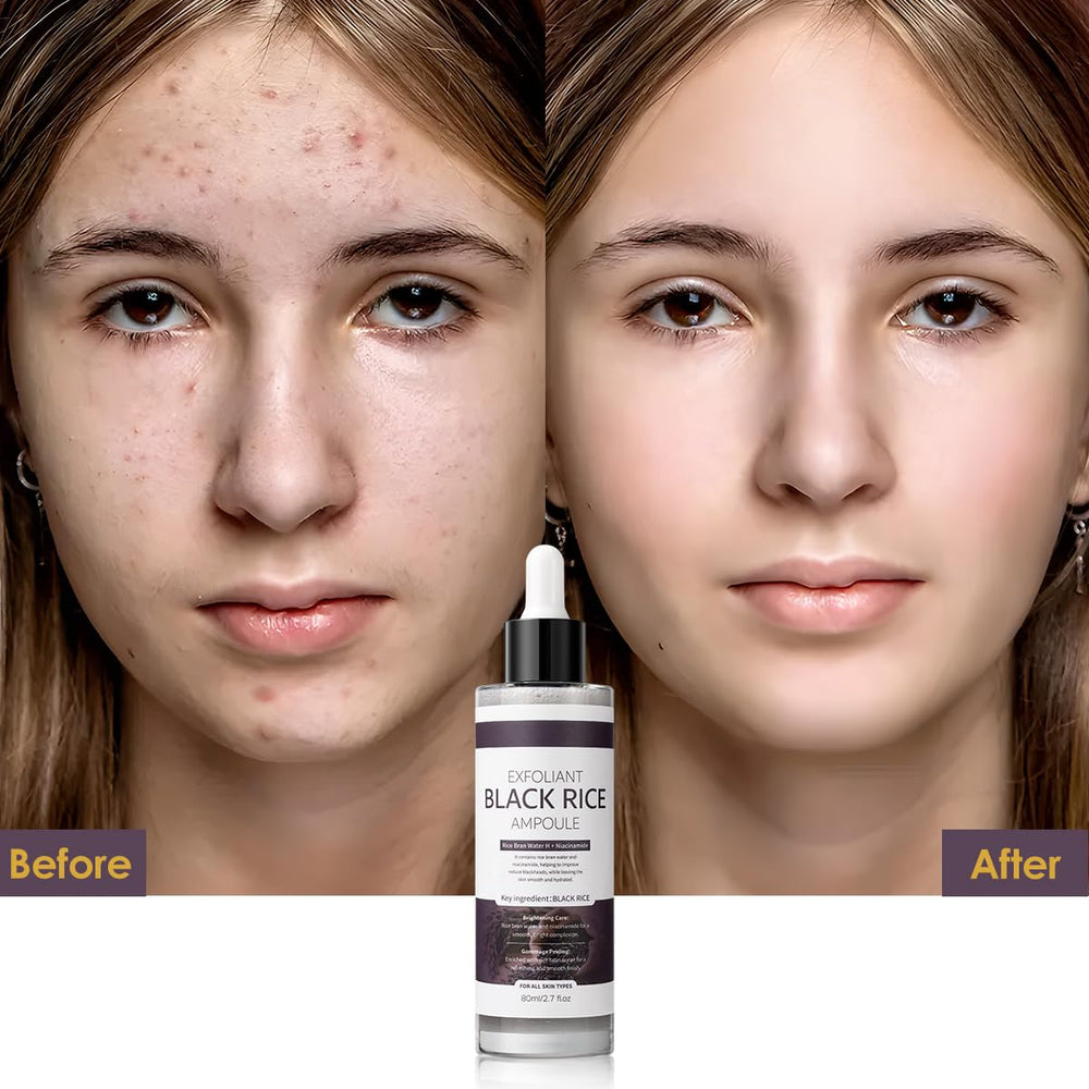 Veakoo Peel Shot Glow ingredients label highlights botanical extracts and rice enzymes.