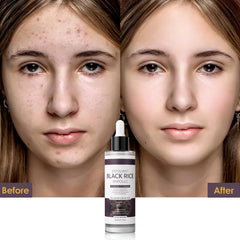 Veakoo Peel Shot Glow ingredients label highlights botanical extracts and rice enzymes.