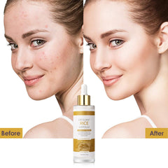 Veakoo Peel Shot Glow rice-bran-water hydrates and strengthens skin barrier
