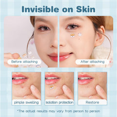 Adult-friendly use with subtle designs for convenient blemish coverage