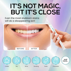 Teeth whitening gel kit compatible with any dental tray