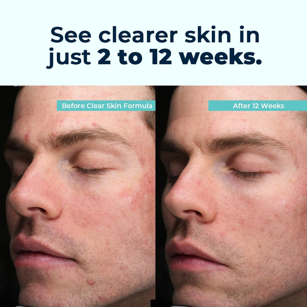 Key ingredients: vitamins A, C, E, zinc, selenium, and chromium