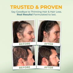 Two capsules daily serving of Vital Hair Complex
