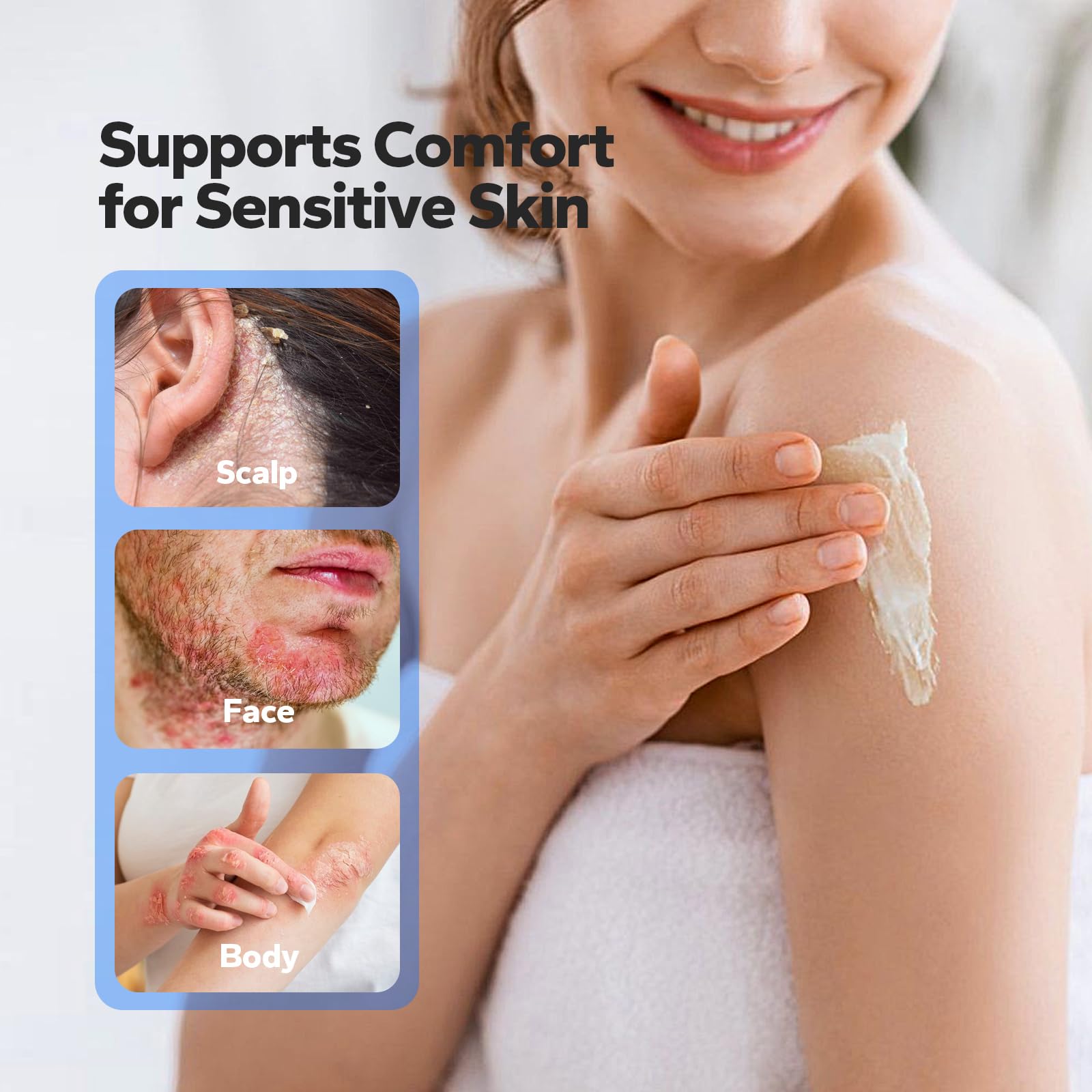Vomovo Seborrheic Dermatitis Cream texture close-up highlights quick absorption and non-greasy finish.