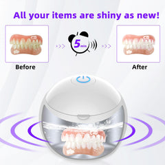 Whitening Trays Cleaning with Ultrasonic and UV-C