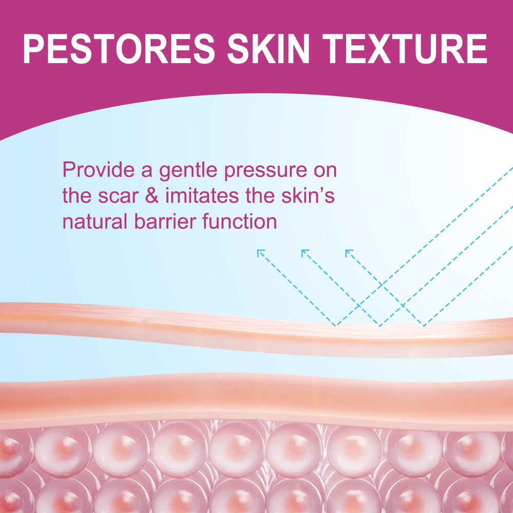 Vortexonix medical-grade silicone material delivers gentle, skin-friendly scar care.