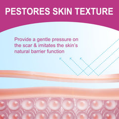 Vortexonix medical-grade silicone material delivers gentle, skin-friendly scar care.
