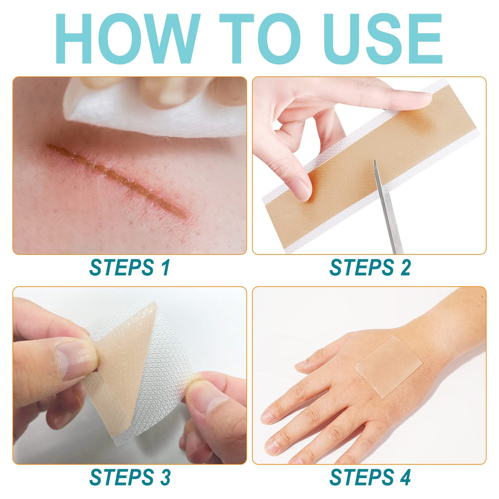 Vortexonix silicone scar sheets reusable after washing for ongoing care