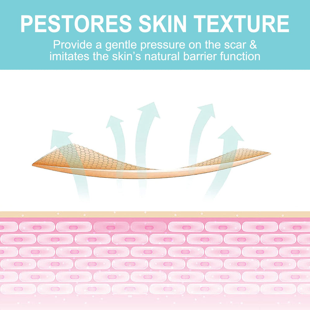 Vortexonix silicone scar sheets safe for all ages with skin-friendly material