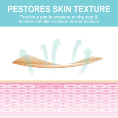 Vortexonix silicone scar sheets safe for all ages with skin-friendly material