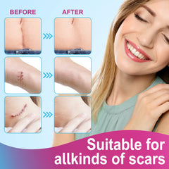 Vortexonix translucent skin-tone design blends with your skin during wear.