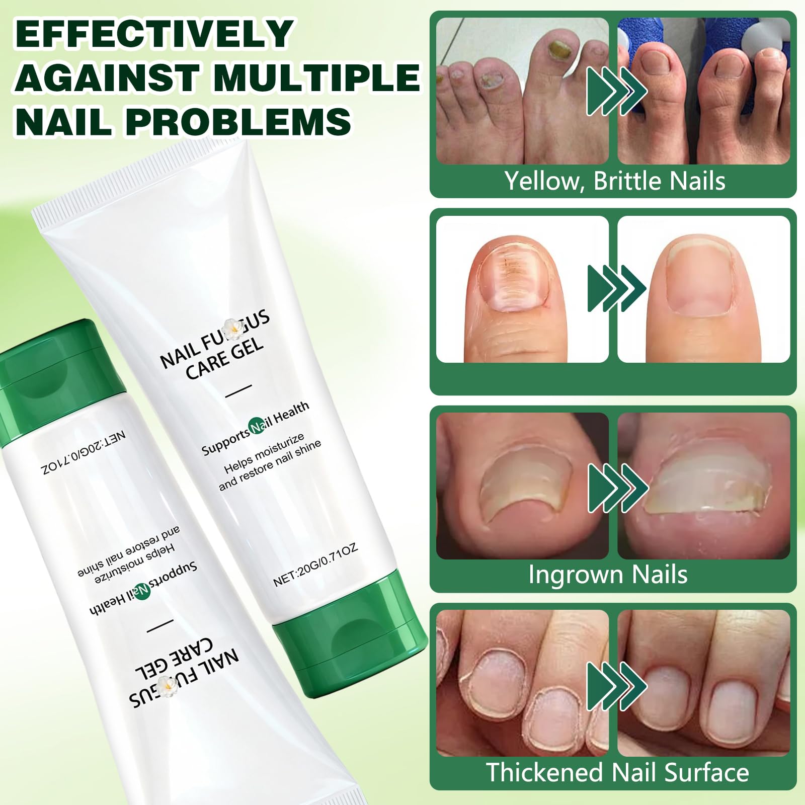 Wandyme foot care cream tub for daily moisturization