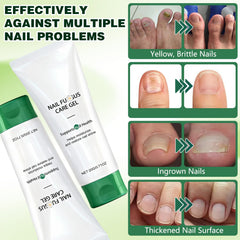 Wandyme foot care cream tub for daily moisturization