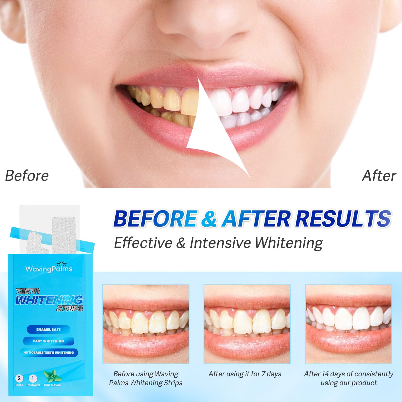 Application of Waving Palms whitening strips on teeth