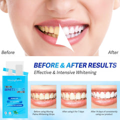 Application of Waving Palms whitening strips on teeth