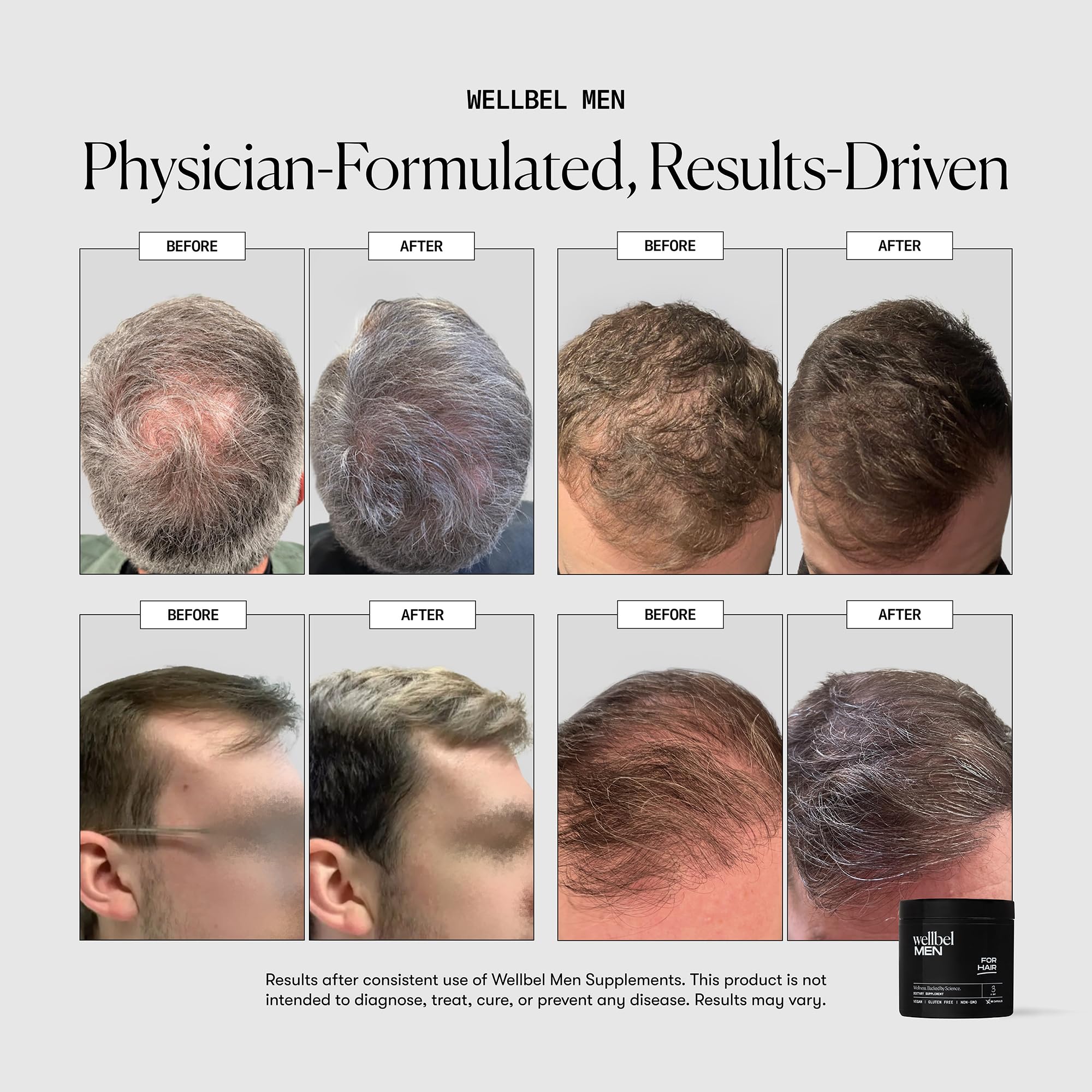 Saw Palmetto ingredient for hair support