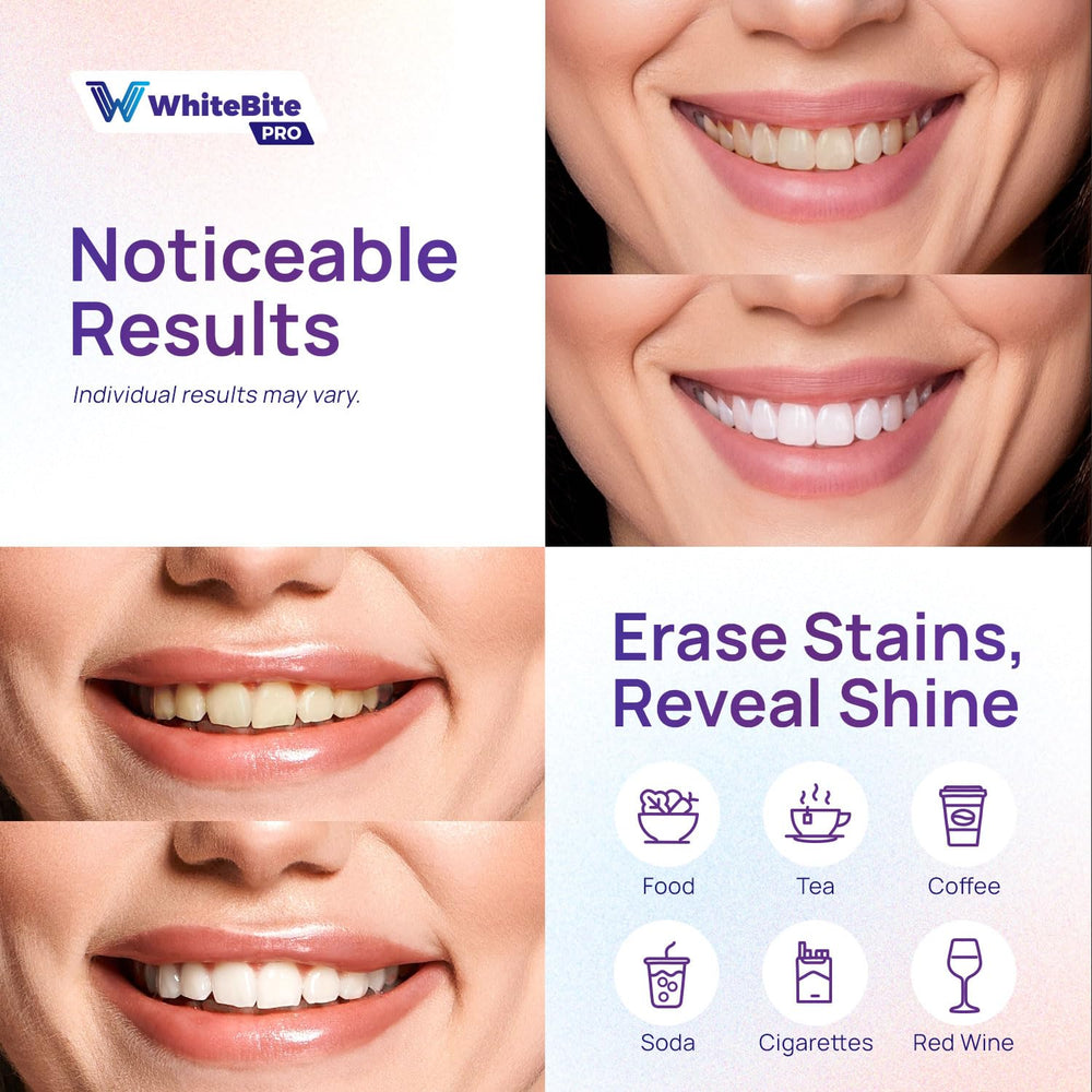 Whitebite Pro Purple Teeth Whitening Strips, 28 Strips (14 Treatments ...